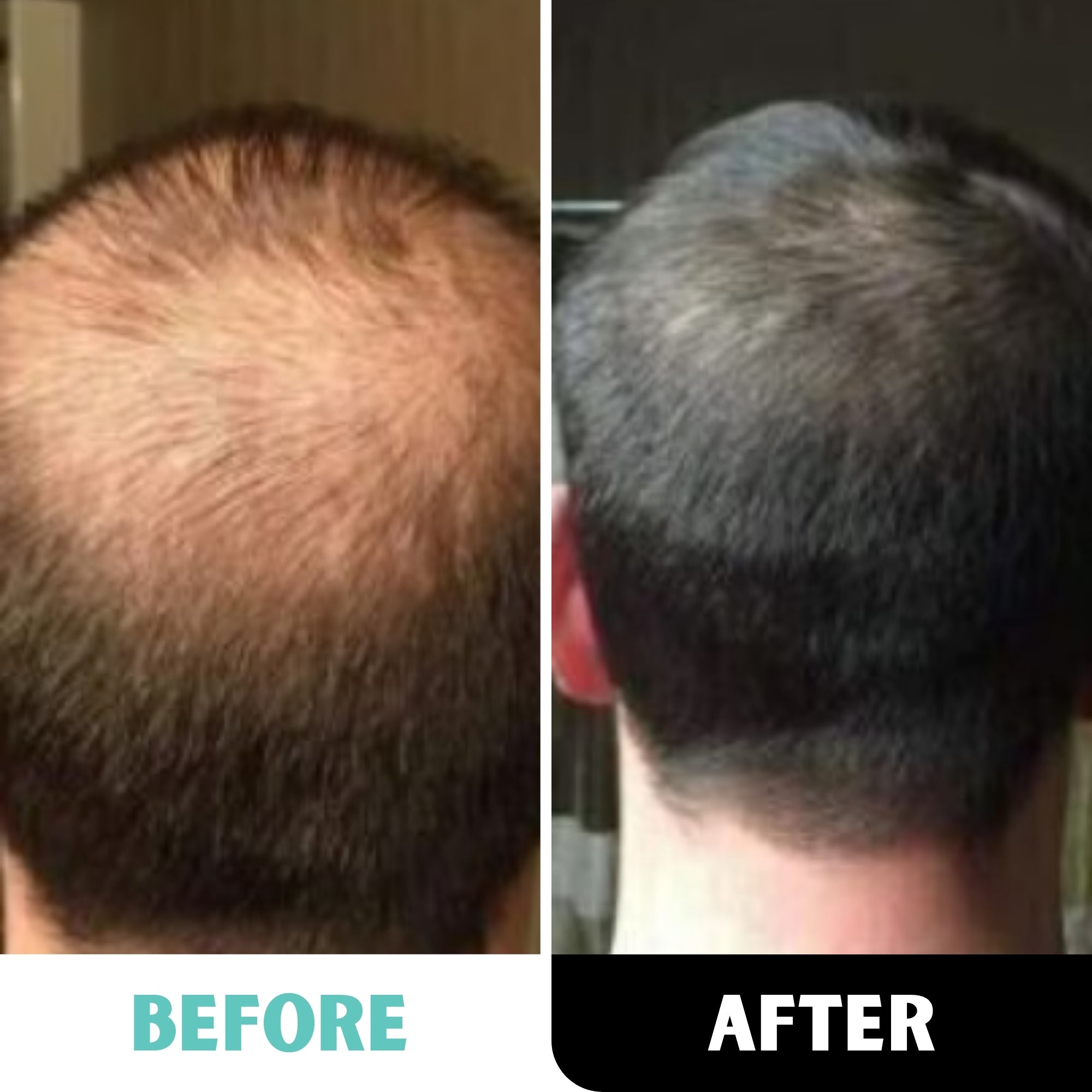 100% Honduran Batana Oil