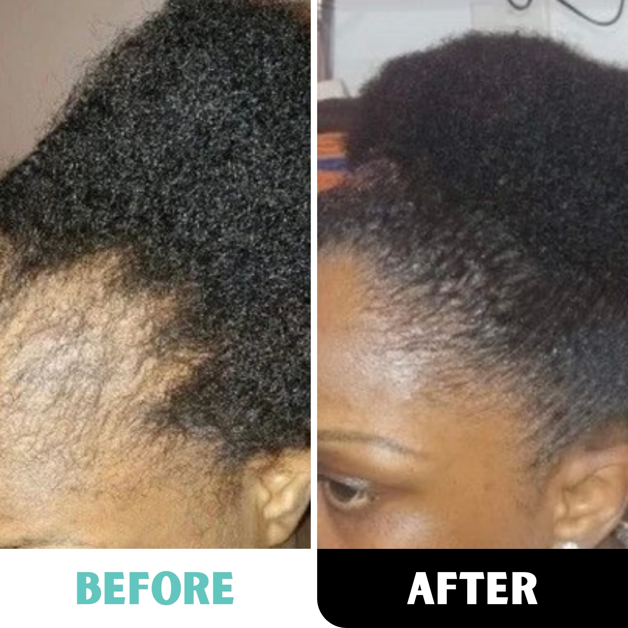 100% Honduran Batana Oil