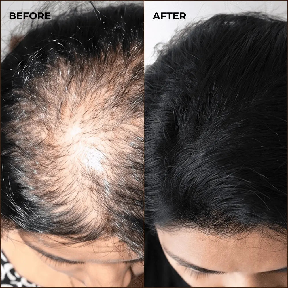 Before and after crown thinning